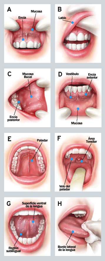 Autoexamen Bucal